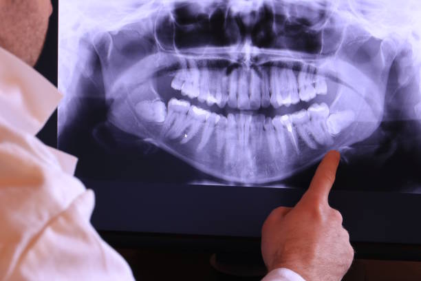 Urgent Tooth Repair in VA